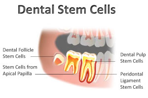 Stem cells from teeth